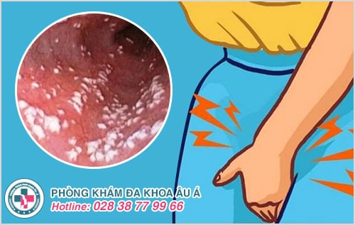 Tổng hợp những bệnh phụ khoa thường gặp ở nữ giới