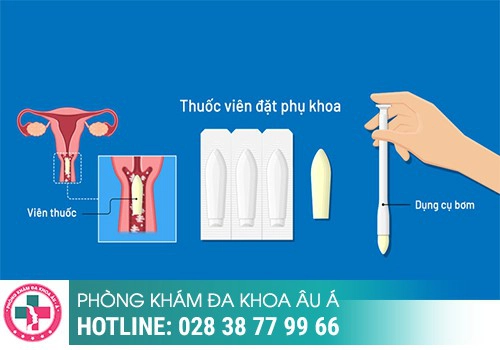 CÁCH ĐIỀU TRỊ NẤM ÂM ĐẠO HIỆU QUẢ VÀ NHANH CHÓNG