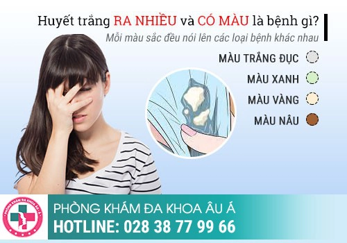 Như thế nào là khí hư bất thường?