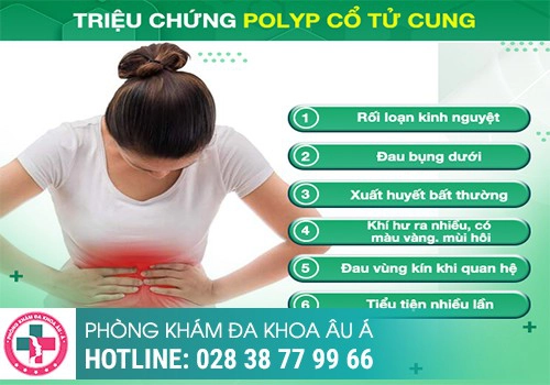 Polyp cổ tử cung chia làm mấy giai đoạn?