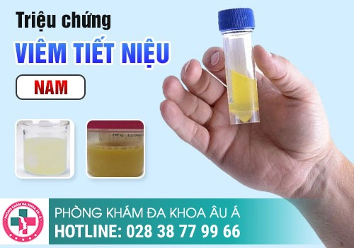 KIỂM TRA XEM BẠN CÓ BỊ NHIỄM TRÙNG TIỂU HAY KHÔNG