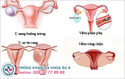 Trung tâm tư vấn phụ khoa 