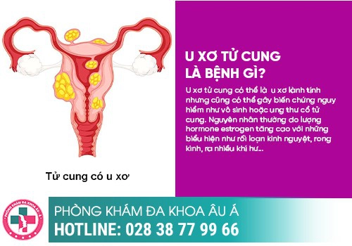 NHỮNG BỆNH PHỤ KHOA THƯỜNG GẶP Ở NỮ GIỚI
