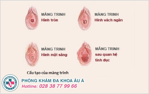 Vá màng trinh và những điều cần biết