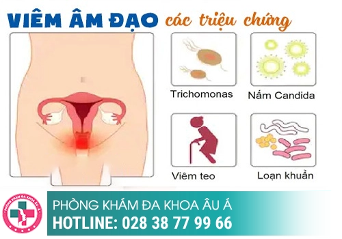 Dấu hiệu viêm nhiễm phụ khoa