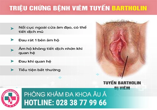 Nổi mụn ở môi lớn và môi bé âm đạo cảnh báo nguy hiểm 