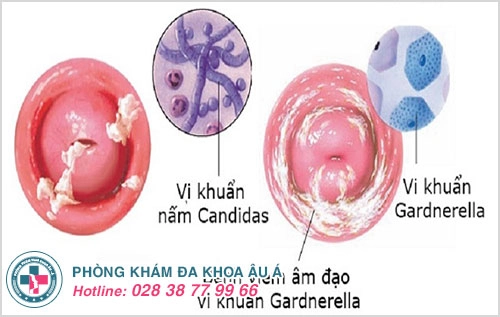 Phòng khám phụ khoa uy tín nhất TPHCM