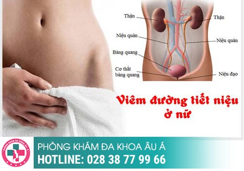 Viêm đường tiết niệu