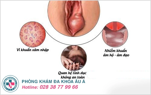 U cục sưng cứng gần âm đạo 