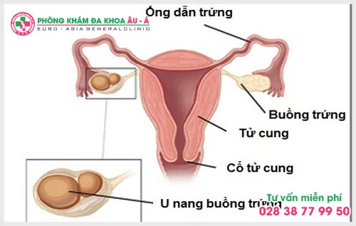 5-benh-phu-khoa-ma-nu-gioi-hay-mac-phai