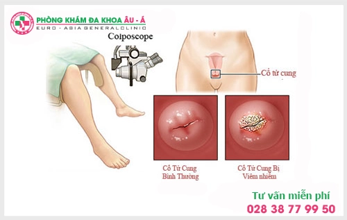 Phòng khám chuyên trị viêm lộ tuyến tại HCM