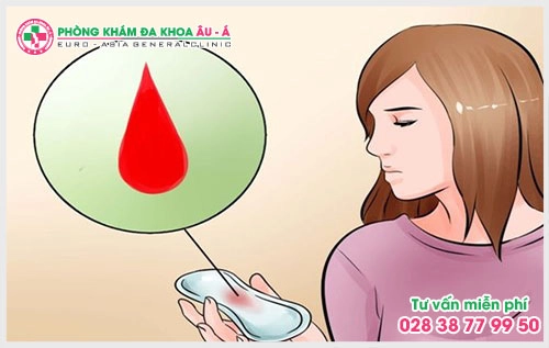 Thật cẩn trọng khi chảy máu âm đạo bất thường