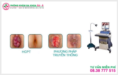 hỗ trợ điều trị trĩ ngoại hiệu quả  ở đâu tại TPHCM