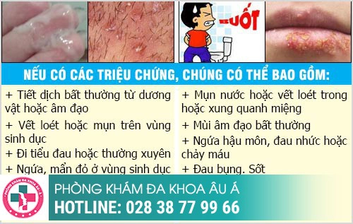 Thời gian ủ bệnh xã hội, bệnh xã hội ủ trong bao lâu, bệnh xã hội bao lâu tái phát Thời gian ủ bệnh xã hội, bệnh xã hội ủ trong bao lâu, bệnh xã hội bao lâu tái phát