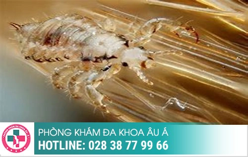 Thời gian ủ bệnh xã hội, bệnh xã hội ủ trong bao lâu, bệnh xã hội bao lâu tái phát Thời gian ủ bệnh xã hội, bệnh xã hội ủ trong bao lâu, bệnh xã hội bao lâu tái phát