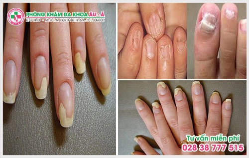 Phòng khám chữa bệnh da liễu - Đa Khoa Âu Á luôn đảm bảo các mức chi phí thăm khám và chữa trị bệnh công khai minh bạch, niêm yết theo từng hạng mục mà ban hành.