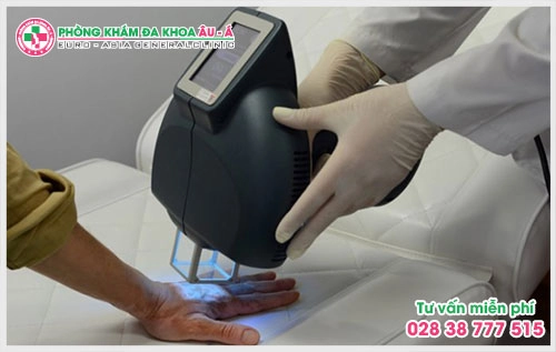 Thuốc trị bệnh bạch biến của Nhật mới hiện nay