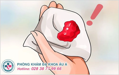 Sót thai, sót nhau sau phá thai: hệ lụy nguy hiểm và cách xử lý Sót thai, sót nhau sau phá thai: hệ lụy nguy hiểm và cách xử lý